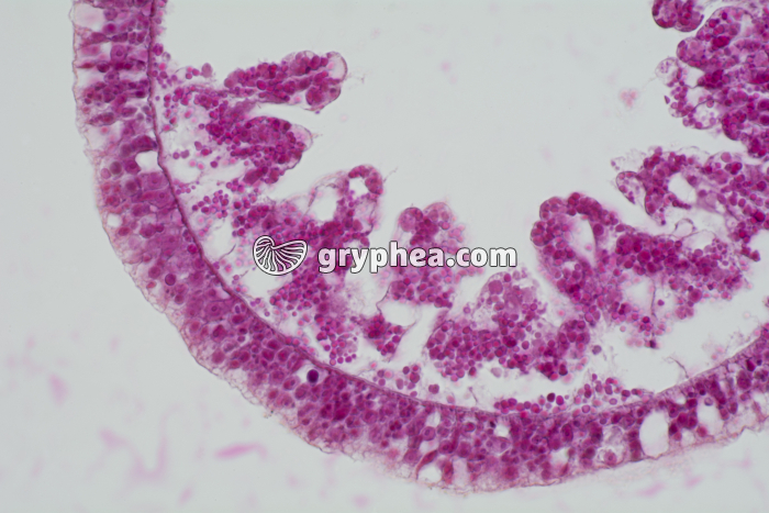 Hydre CT x100 - gryphea.org